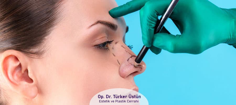 Burun Estetiği